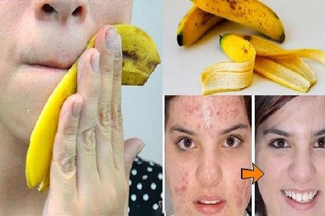 stop-throwing-away-banana-peels-10-ways-can-use_result