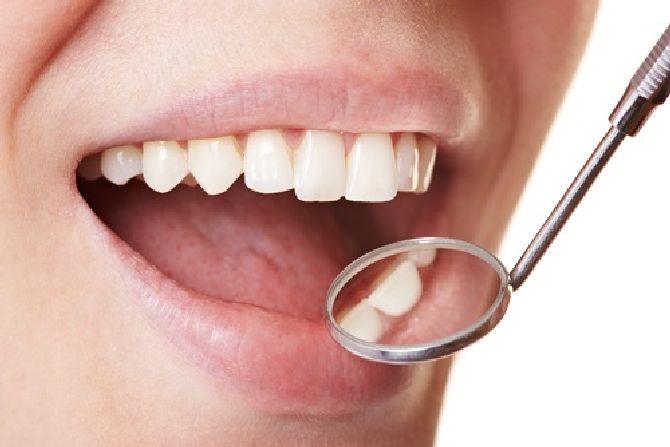 zubnoi-nalet_result