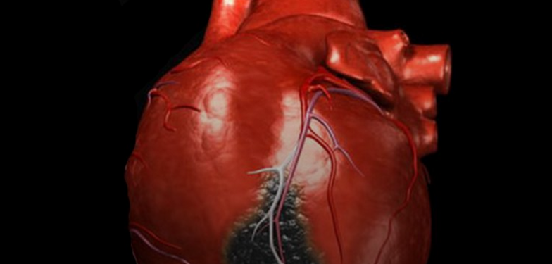 Как распознать наверняка признаки инфаркта и успеть спасти свою жизнь
