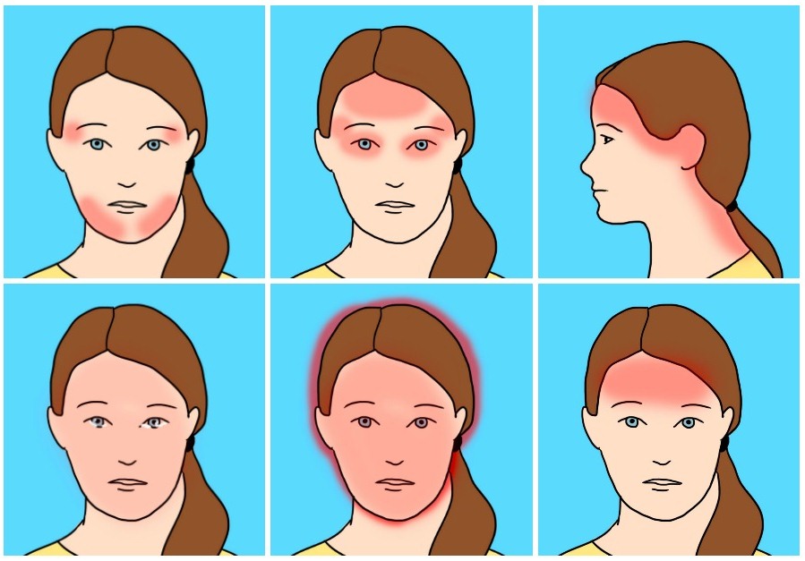 О чем свидетельствуют разные виды головной боли и как правильно с ними бороться