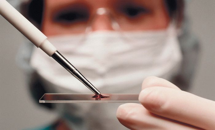 Ученые научились по анализу крови предсказывать смерть