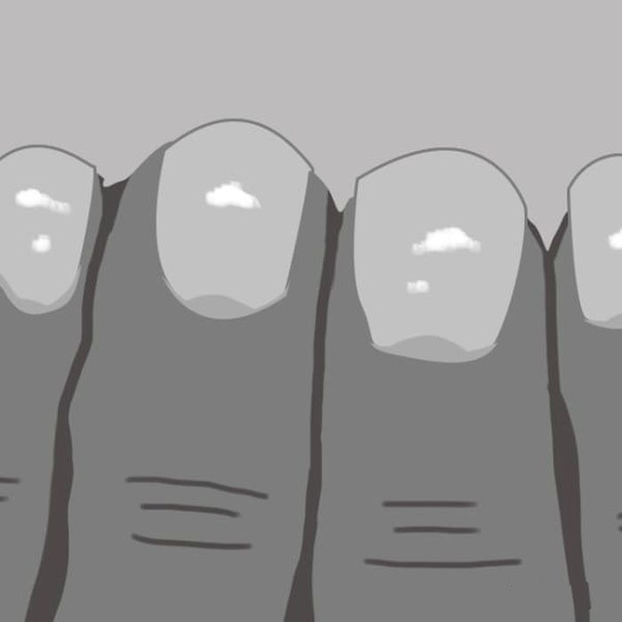 О чем на самом деле говорят белые пятна на ногтях и другие сигналы организма