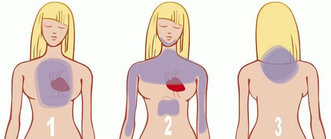Как распознать сердечный приступ за месяц до того, как он может случиться