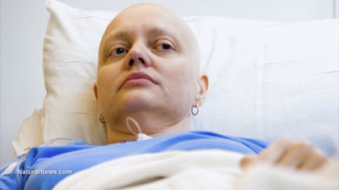 Афера в индустрии лечения рака: на химиотерапии по ложным диагнозам наживают миллиарды долларов