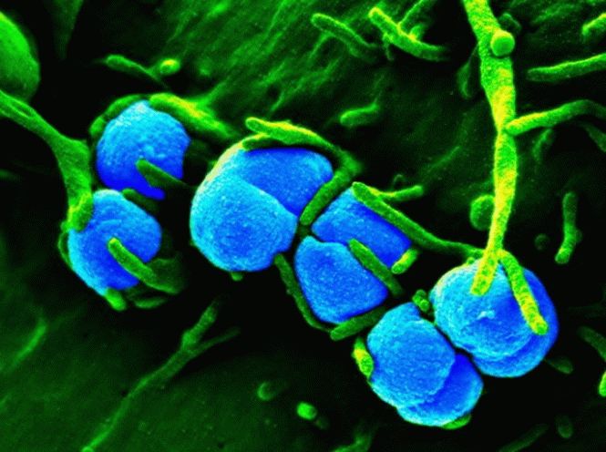 Вирусы, грибки, бактерии – причины эрозивного баланопостита