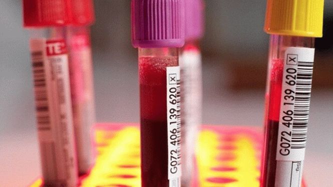 Новый анализ крови поможет диагностировать 5 различных видов рака