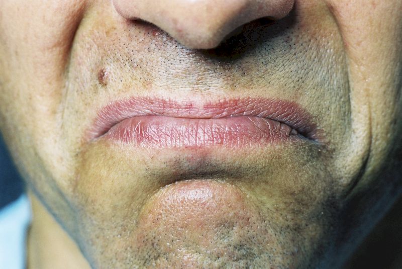 Металлический привкус во рту: 5 причин появления и способы лечения