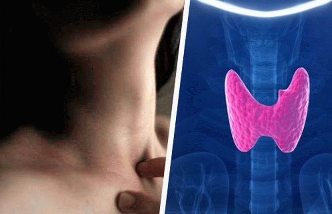 6 привычек, которые вызывают нарушения в работе щитовидной железы