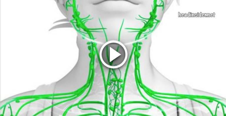 Ваша лимфа забита токсинами, если у вас есть эти 7 симптомов! 10 способов очистки!