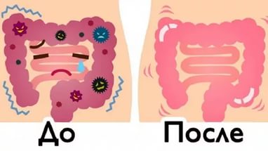 Начало весны - отличная пора, чтобы почистить свою толстую кишку и наслаждаться жизнью