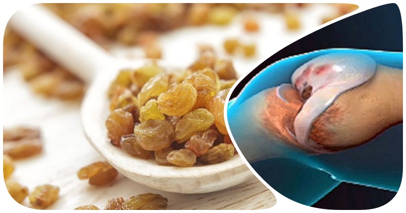 Избавить организм от избытка солей и вылечить суставы поможет изюм с медом