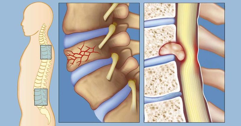 Боль в спине может быть признаком гораздо более серьезного заболевания: 6 симптомов хвори в организме