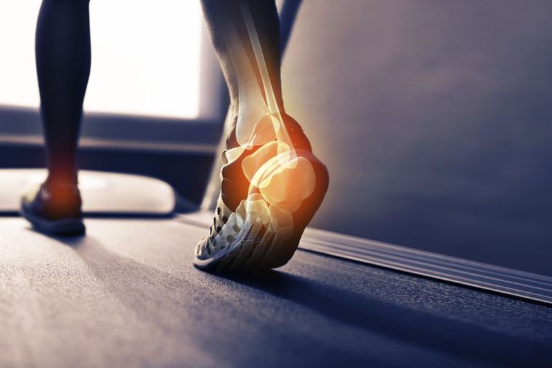 Острая боль в пятке как сигнал воспаления связок: что о вашем здоровье могут рассказать ноги