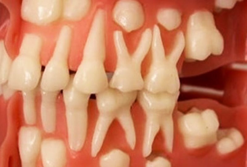 Вы можете вырастить новые зубы самостоятельно за 9 недель: невероятное открытие профессора стоматологии