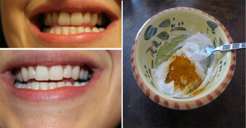 Домашняя отбеливающая зубная паста: противовоспалительное средство без химии сделает вас красивым зубастиком