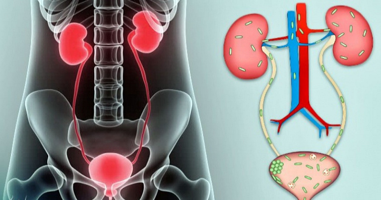 Замучили инфекции в почках и мочевом пузыре - поможет народное снадобье на основе петрушки и меда