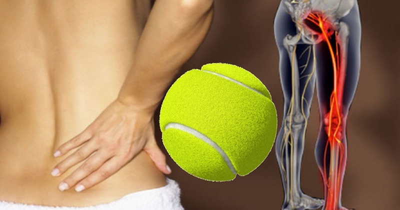 Теннисный мяч против болей в спине: малоизвестная техника против воспаленного седалищного нерва