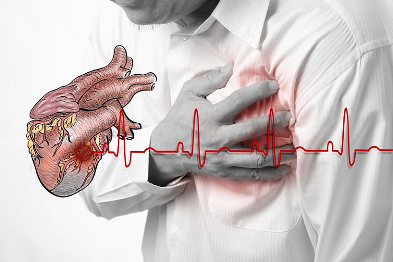 Как определить предпосылки сердечного приступа и спасти себя от смертельного риска