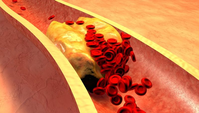Простой эликсир для сжигания холестерина в артериях: достаточно смешать 2 сока, разбавив смесь пряностями