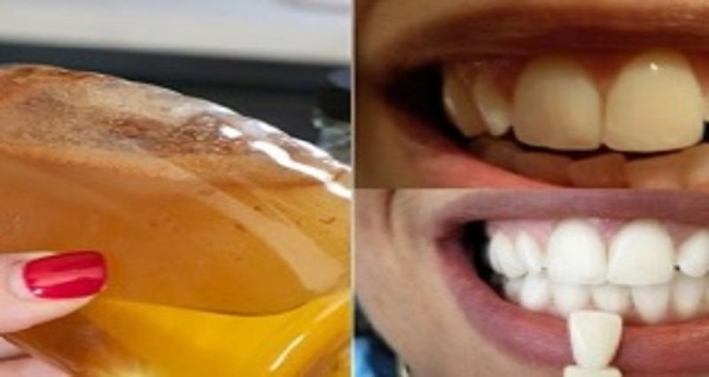 Яблочный уксус: простой способ оздоровить и отбелить зубы