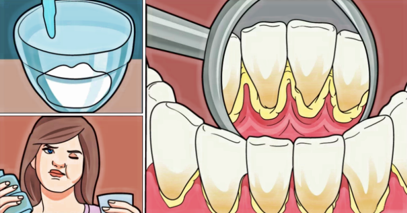 Убивает бактерии и отбеливает зубы: готовим домашний ополаскиватель для рта без химии