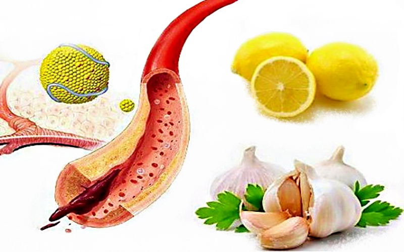 Помогут 4 баночки настойки: очищаем кровеносные сосуды с помощью чеснока и лимона