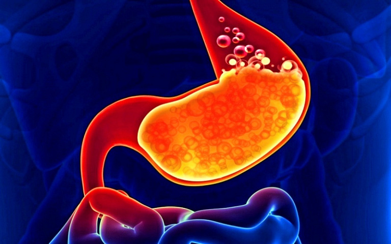Регулярная изжога как первый возможный сигнал о раке желудка