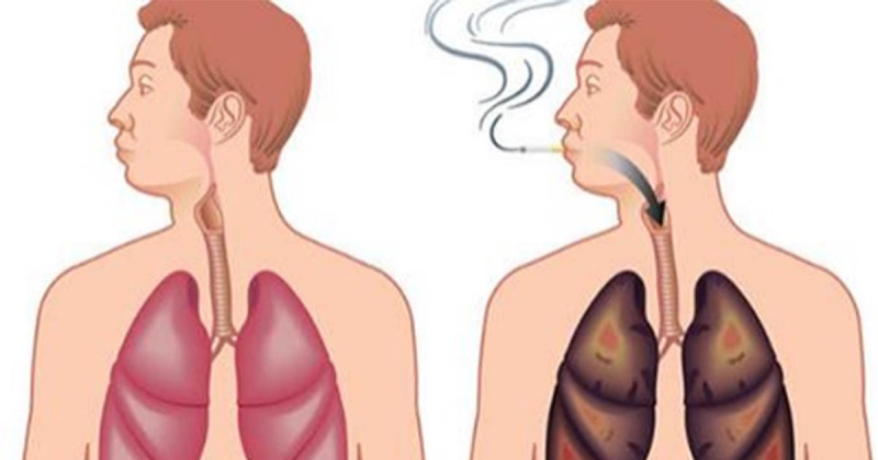 Особенности питания курильщиков: какие витамины требуются и как выводить токсины