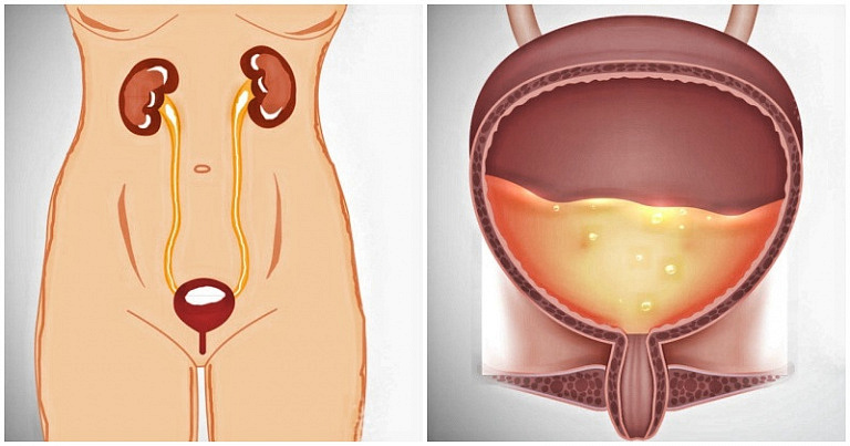 Опасные болезни почек: 10 симптомов, которые не следует упускать из виду