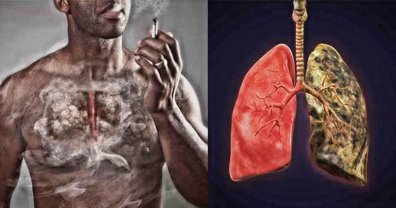 Кашель курильщика - 7 способов уменшить последствия курения