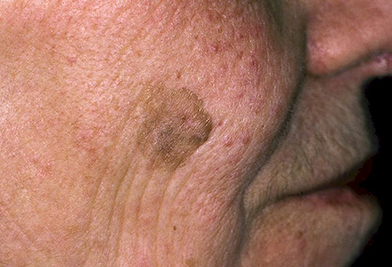 15 возрастных болезней кожи, которые нас всех поджидают