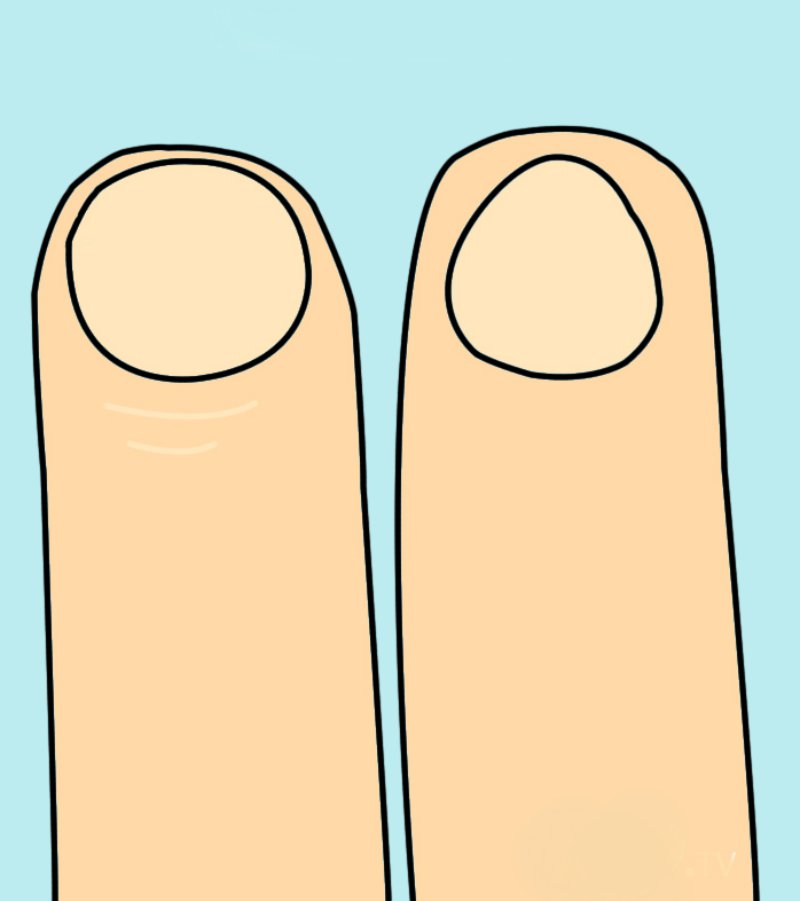 О чем говорит форма ногтей. Круглая форма ногтей характер человека. Круглая форма ногтей характер. Форма ногтей круглая эскиз. Ногти круглые характер.