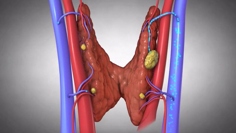 Щитовидная железа и 18 признаков, что она больна