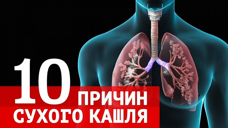 10 причин сухого кашля и как его вылечить по-настоящему