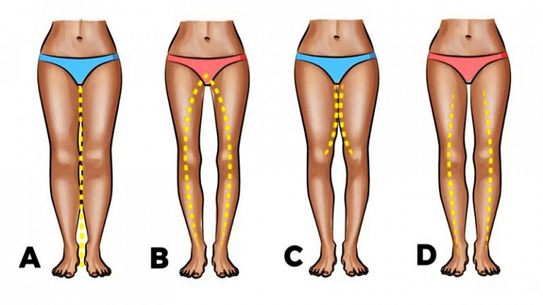 Что форма ног и их кривизна могут рассказать о женщине как партнерше в отношениях