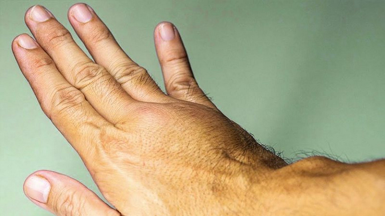 6 признаков смертельно опасного тромба в ваших венах