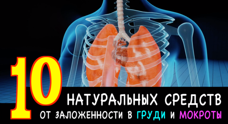 10 доступных натуральных средств от заложенности в груди и мокроты