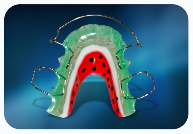 Ортодонтические пластинки – залог здоровых зубов и сияющей улыбки вашего ребенка