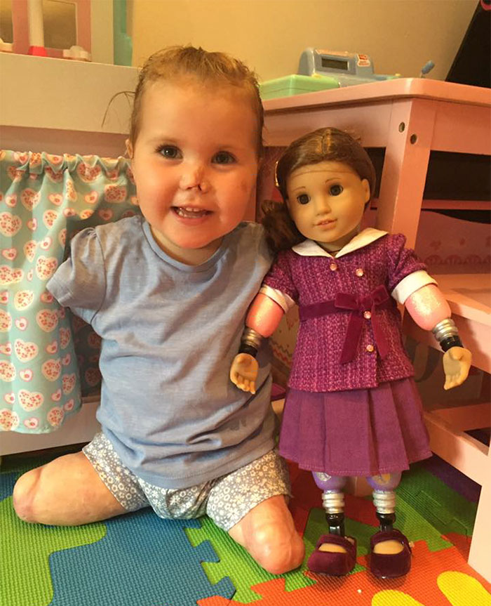 Без рук і ніг, але тепер щасливіша: 2-річній дівчинці подарували особливу ляльку і все змінилося
