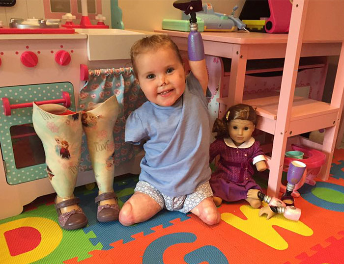 Без рук і ніг, але тепер щасливіша: 2-річній дівчинці подарували особливу ляльку і все змінилося